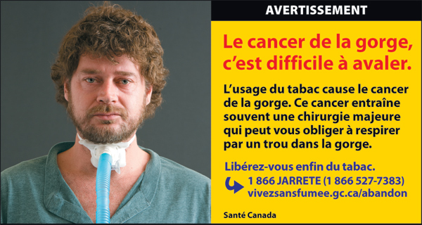 Canada 2012  Health Effects other - lived experience, throat cancer - cigars fr